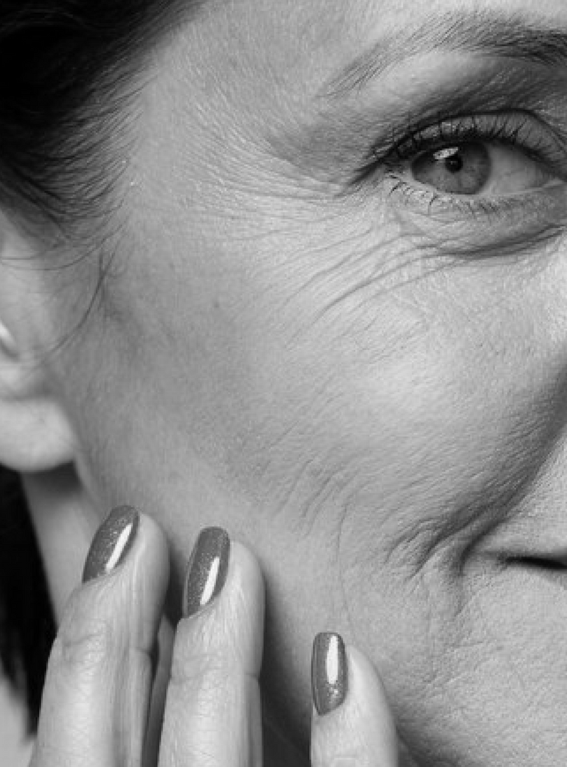 Fine lines and wrinkles